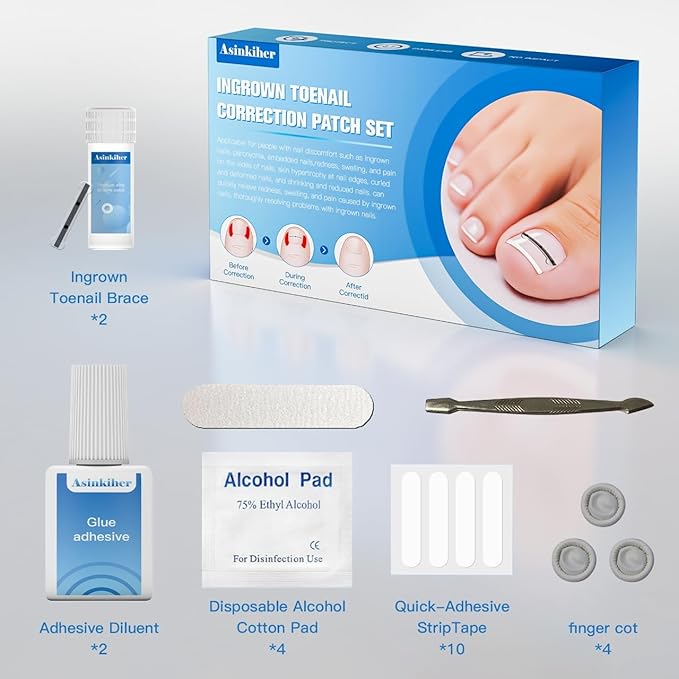 Titanium Alloy Ingrown Toenail Treatment, Ingrown Toenail Removal Kit for Curved Nail Repair, Ingrown Nail Tool for Home Use