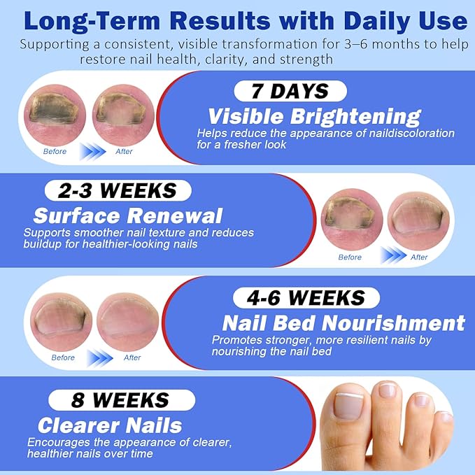 Fungal Nail Patches for Toenails, 21 Pcs Fungus Nail Patches, Toenail Fungus Treatment Extra Strength - Overnight Repair for Nail Fungus Damage, 8-Hour Restores Healthy Appearance, Easy to Apply