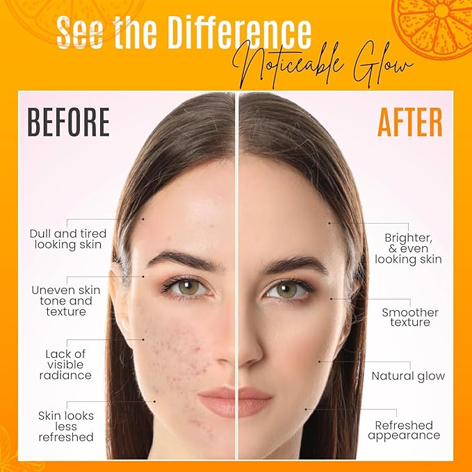 30% Vitamin C Serum (2 Fl Oz) Pure Organic Anti- Wrinkle + Hyaluronic Acid + Retinol + Vitamin E + Vitamin B, Facial Serum For Anti-aging, Wrinkles, And Fine Lines.