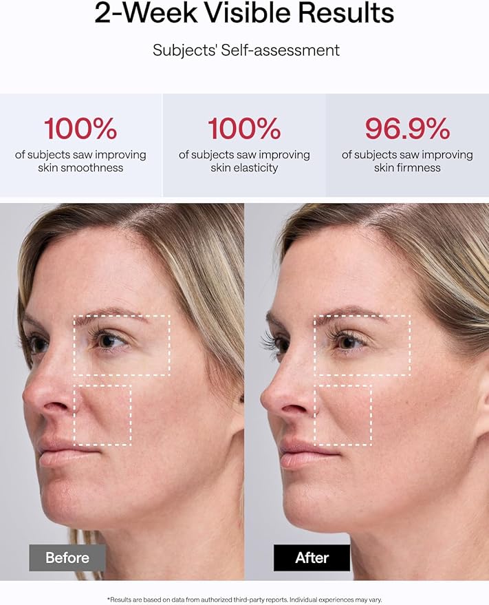 JMOON NouvelleSkin Facial Toning Device, M30U Red Light Therapy for Face, FDA-Cleared for Safer Treatment of Facial Wrinkles, 4 Modes, 5 Energy Levels for Full Face, JMOON Gel Included