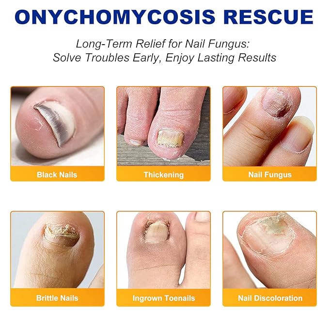 Toenail Fungus Treatment Extra Strength,32 Pcs Nail Patches for Nail Treatment Overnight, Nail Repair for Damaged Nails, Nails Care Supplies, Restore Discoloration and Thickness