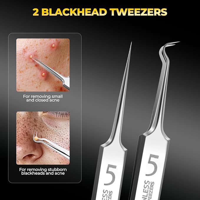 Professional Blackhead Remover Tools,Pimple Popper Tool Kit,Blemish, Whitehead Popping, 8 Pcs Zit Removing for Nose Face, Ingrown Hair Tweezers and Pore Prep Tool