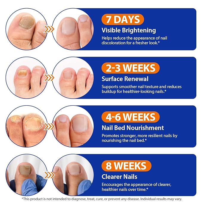 Toenail Treatment Extra Strength - 32 Pcs Nighttime Nail Patches, Overnight Toe Nail Treatments for Damaged Nails Foot Nails Repair and Care, 8-Hour Restores Healthy Appearance (2PCS)