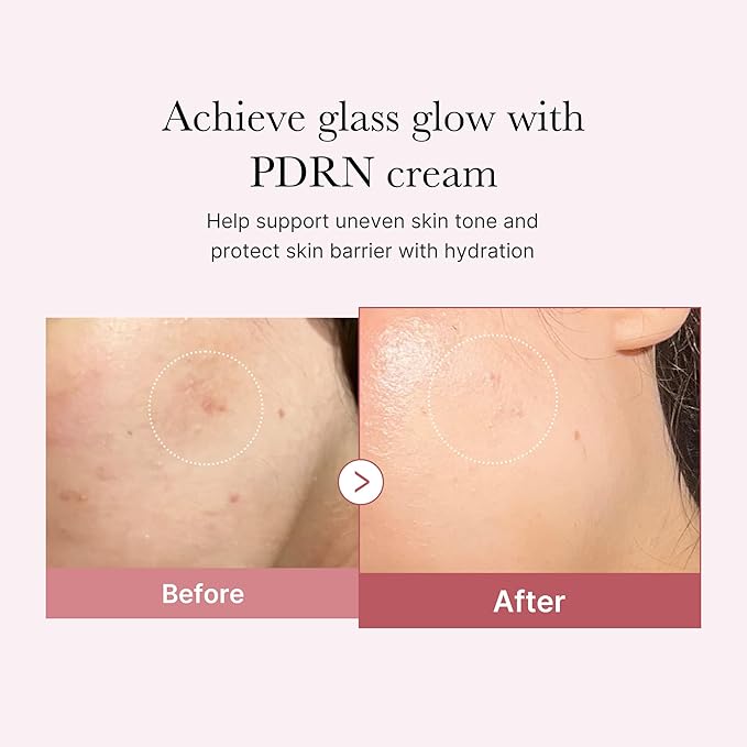 medicube PDRN Pink Hyaluronic Moisturizing Cream | Blemish Recovery, Relief & Hydrating Care | Restores Skin Elasticity & Glow | Korean Skincare for Even Skin Tone & Pore Care | 50ml / 1.69 fl.oz.