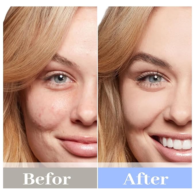 Chlorella Deep Hydrating Mask,with Bio-Collagen,Hyaluroic Acid and Chorella | Sheet Facial Mask Skincare | Improves Hydrating,Firming,Glowing | Skin moisturizer masks,5ea