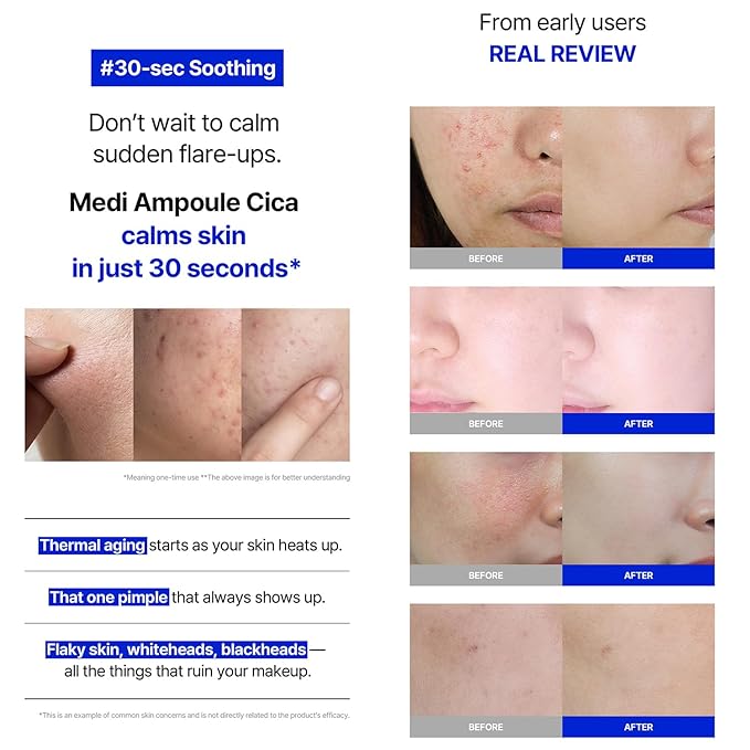 MILLIMILLI MediAmpoule – Cica Serum | Calming Centella Asiatica Face Ampoule with TECA & Panthenol | Hydrating Korean Skin Care Serum for Face, 15ml