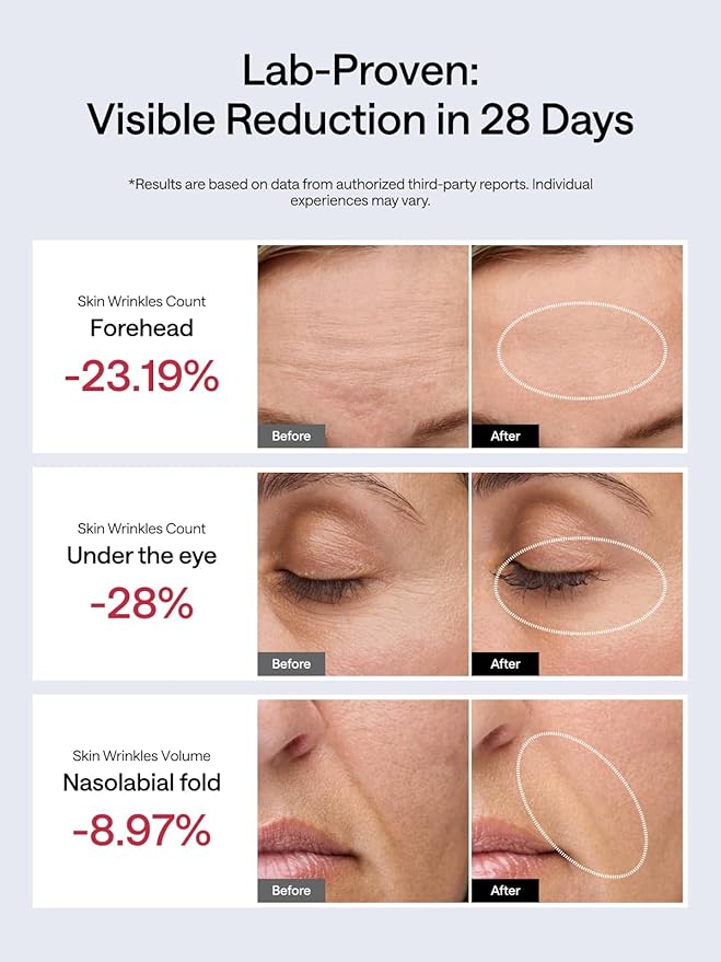 JMOON NouvelleSkin Facial Toning Device, M30U Red Light Therapy for Face, FDA-Cleared for Safer Treatment of Facial Wrinkles, 4 Modes, 5 Energy Levels for Full Face, JMOON Gel Included