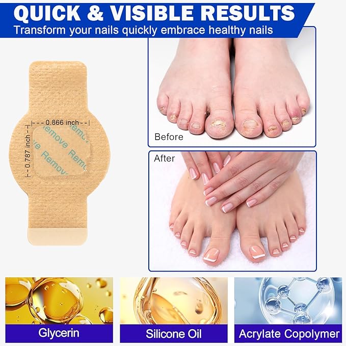 Fungal Nail Patches for Toenails, 21 Pcs Fungus Nail Patches, Toenail Fungus Treatment Extra Strength - Overnight Repair for Nail Fungus Damage, 8-Hour Restores Healthy Appearance, Easy to Apply