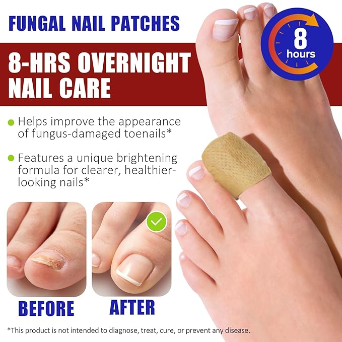 Toenail Treatment Extra Strength, 32 Pcs Nail Patches Overnight Nail Fast Acting Care for Damaged Nails- Visible Results in 8 Hours-Renewal for Men and Women