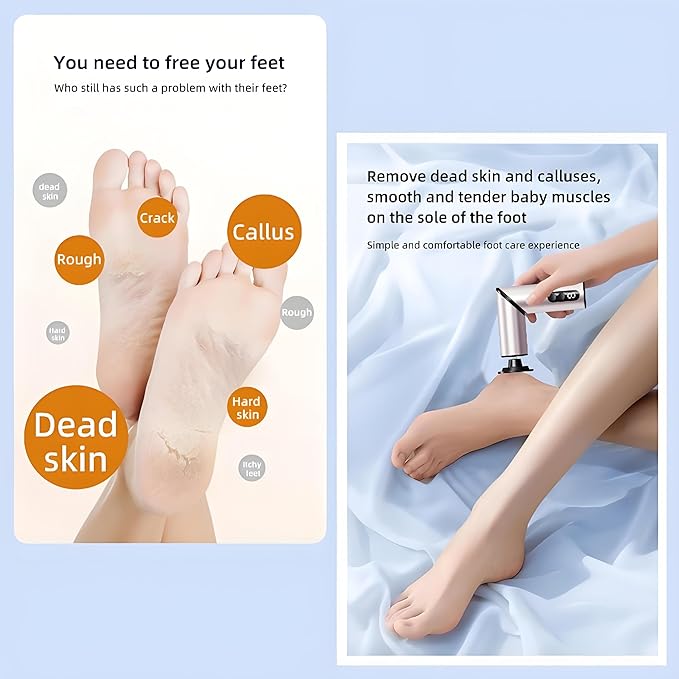 Foldable Electric Foot Callus Remover, Foot Files, 9-Speed Foot Sander Pedicure Tools for Feet Dead Skin with Sandpaper Disk and Nail Drill Bits(Rose Gold)