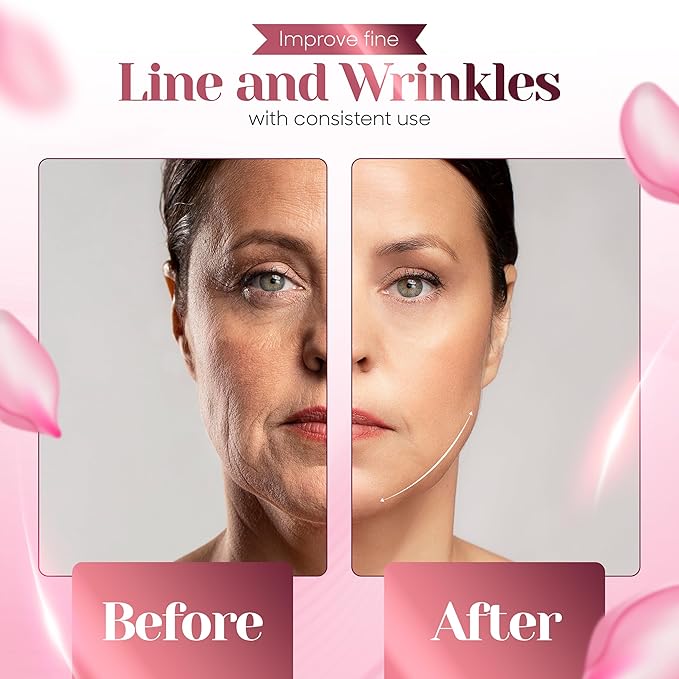 KLY Beauty 7-in-1 Beauty Facial Massager for Face and Neck – Thermal & Vibrating Facial Tool for Wrinkle Reduction, Skin Firming, Skin Lifting and Skin toning| With Retinol Collagen Creme