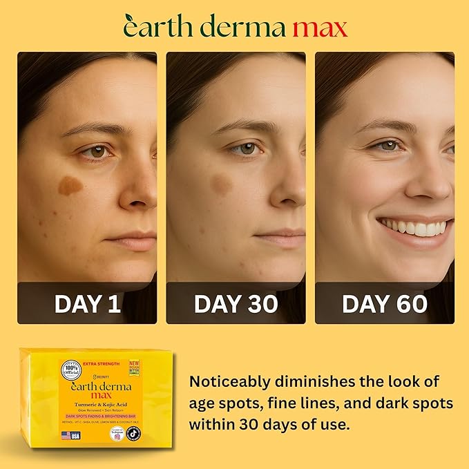 Earth Derma Max Beauty Turmeric & Kojic Acid Dark Spots Fading Bar, Extra Strength Formula with Retinol, Vitamin C, Shea Oil, Designed in USA