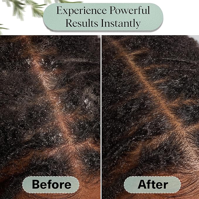 Kitsch Rosemary Oil for Hair Growth – Hair Oil with Biotin, Castor & Jojoba – Pre-Wash Scalp oil for Hair Care – Lavender Scent – 10mL