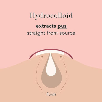 a.l.m. Magical Patch: Hydrocolloid pimple patches. These ultra thin & translucent hydrocolloid adhesive covers and absorb unwanted pimples. Parches Para Acne for skincare.