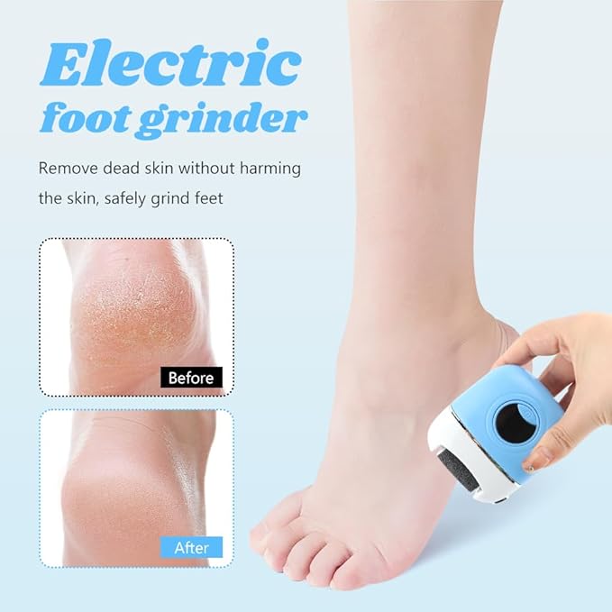 Electric Foot Callus Remover - 3 Grinding Heads & LCD Display for Fast Tough Skin Removal, Women's Home Pedicure Tool for Daily Care & Salon-Like Smooth Feet