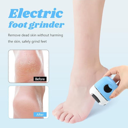 Electric Foot Callus Remover - 3 Grinding Heads & LCD Display for Fast Tough Skin Removal, Women's Home Pedicure Tool for Daily Care & Salon-Like Smooth Feet