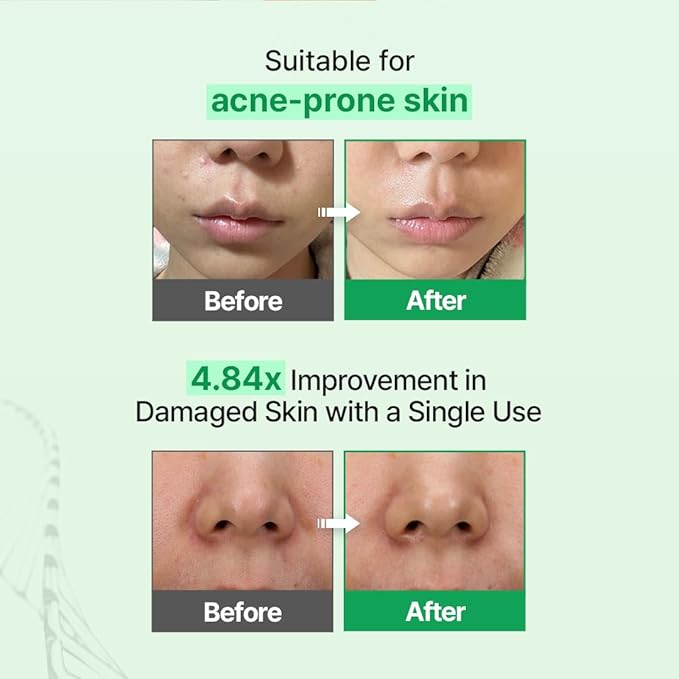 Zipiderm EGF Skin Barrier Cream Toner – Korean Milky Hydrating Formula with Ceramide, Hyaluronic Acid, Rice Bran & Soy Protein, Moisturizing K-Beauty Skincare for Dry Sensitive Skin, 5.07 fl oz