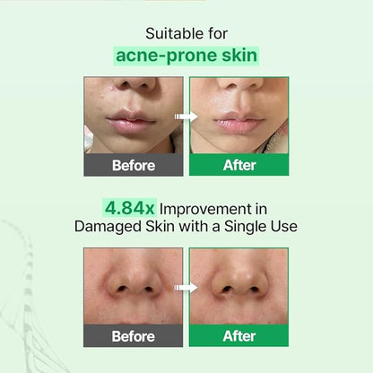 Zipiderm EGF Skin Barrier Cream Toner – Korean Milky Hydrating Formula with Ceramide, Hyaluronic Acid, Rice Bran & Soy Protein, Moisturizing K-Beauty Skincare for Dry Sensitive Skin, 5.07 fl oz