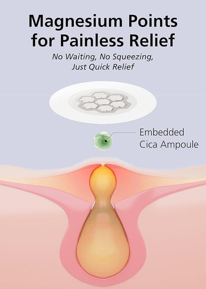 EasyDerm Micro Point Acne Patch Duo – 10 Magnesium Pimple Patches + 6 Real Calming Microdart Patches for Breakout & Post-Blemish Care, 2-Step K-Beauty Skincare Kit