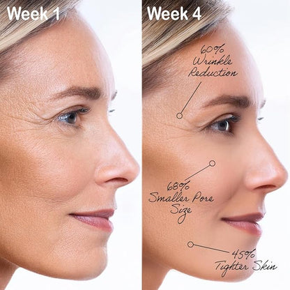 Face Moisturizer For Women. Anti-Aging Wrinkle Cream for Face and Neck with Hyaluronic Acid, Collagen, Squalene, Vitamin C, A & E - Hydrating & Firming Skincare for Women