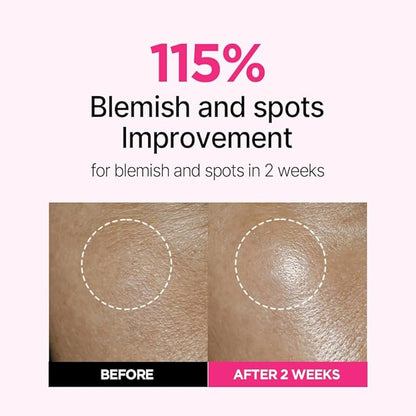 ISOI Blemish Care Up Facial Serum Triple Set, Korean Skin Care Set for Glass Skin Radiance, 2 Full Size & 1 Refill, Eye & Wrinkle Patch Tester, Daily Hydration Skincare Gift for Women (2.13 fl. oz)