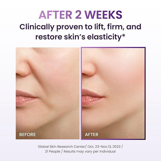 Probioderm 3D Lifting Cream 1.7 fl oz | Advanced Korean Anti-Aging Probiotics Facial Night Cream Moisturizer with 17-Peptide Complex & Patented Probioderm for Wrinkles on Face and Neck
