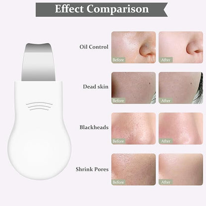 Blackhead Remover Tool,Silicone Face Scrubber, 2 in 1 Nose Pore Scraper for Deep Cleansing,Face Skin Spatula, Nose Black Head Remover, Pore Cleaner Skin Care Tool for Men Women