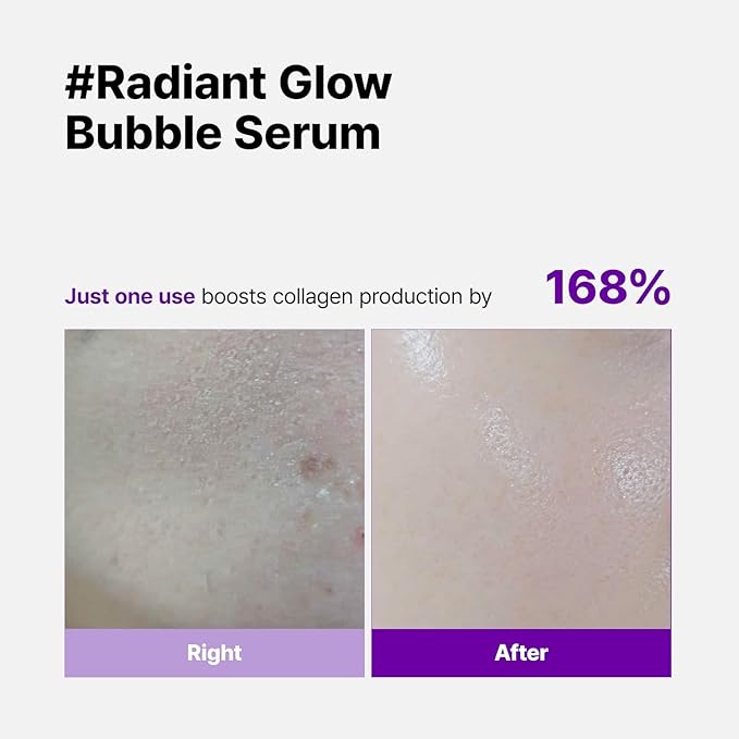 Super Glow Deep Collagen Bubble Serum with 1,005,189ppb Collagen – Anti-Aging, Hydrating, Skin-Firming, Fine Line Care, Korean Skincare – 2.36 fl.oz