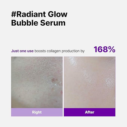 Super Glow Deep Collagen Bubble Serum with 1,005,189ppb Collagen – Anti-Aging, Hydrating, Skin-Firming, Fine Line Care, Korean Skincare – 2.36 fl.oz