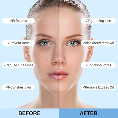 2Pcs Clay Mask For Face, Blackhead Remover For Face, Deep Pore Cleansing, Moisturizing, Skincare Facial Mask for Refining Pores and Controlling Oil (A02#2Pcs Blueberry)