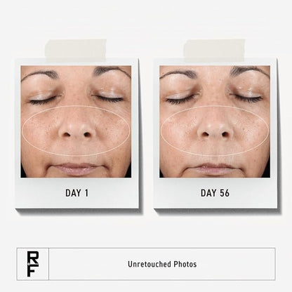 Rodan + Fields Active Hydration Serum | 1oz | Boosts Hydration Levels | Glycerin | Hylauronic Acid