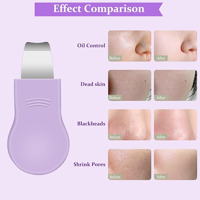 Blackhead Remover Tool,Silicone Face Scrubber, 2 in 1 Nose Pore Scraper for Deep Cleansing,Face Skin Spatula, Nose Black Head Remover, Pore Cleaner Skin Care Tool for Men Women