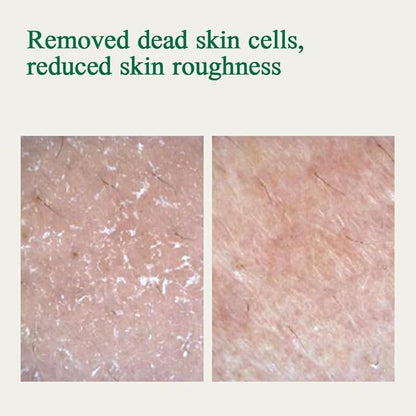 Pyunkang Yul PKY Ultimate Calming Solution Cream for Sensitive Skin with Patented Ingredients, Moisturizer Intensely Calms & Soothes Redness with Cica & Tea Tree, Korean Skincare (1.01 Fl. Oz, 30ml)