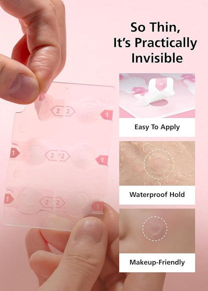 Easyderm Real Calming Patch Pimple Patches, Niacinamide, Hyaluronic Acid, EGF, K-Beauty Skincare | 10 Packs (60 Total) Micro Point length : 285μm