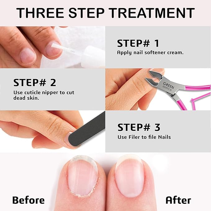 Professional Cuticle Trimmer Nail Cuticle Cutter Stainless Steel Cuticle Nippers with Sharp Blades of Cuticle Remover Clippers Manicure Tools Double Spring for Nail Care Pedicure Nail Tools (Pink)