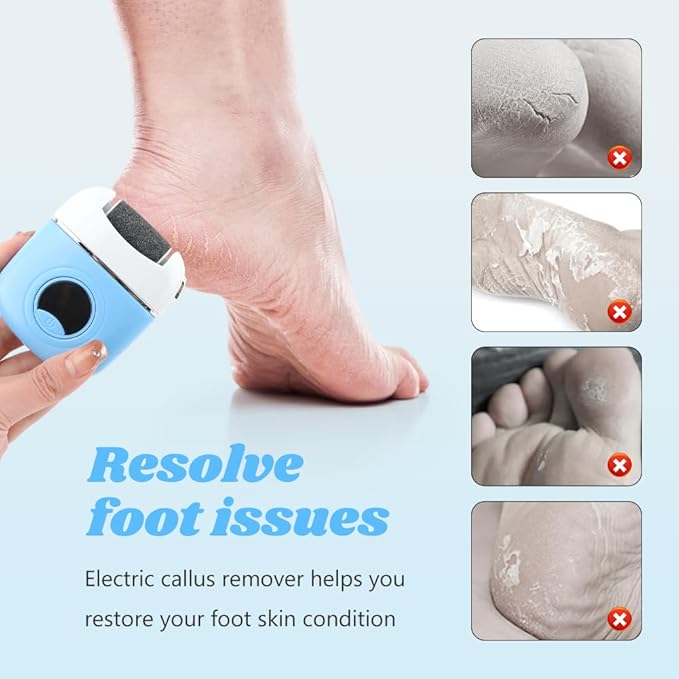 Electric Foot Callus Remover - 3 Grinding Heads & LCD Display for Fast Tough Skin Removal, Women's Home Pedicure Tool for Daily Care & Salon-Like Smooth Feet