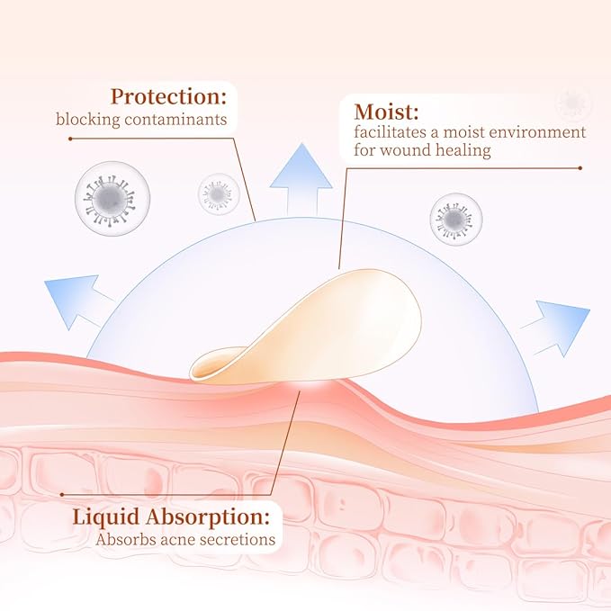 Pimple Patches for Face – 96 Count Hydrocolloid Acne Patch with Salicylic Acid, Tea Tree & Centella – Zit Patches for Blemishes, Breakouts & Spot Treatment