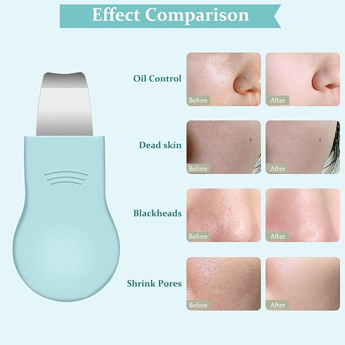 Blackhead Remover Tool,Silicone Face Scrubber, 2 in 1 Nose Pore Scraper for Deep Cleansing,Face Skin Spatula, Nose Black Head Remover, Pore Cleaner Skin Care Tool for Men Women