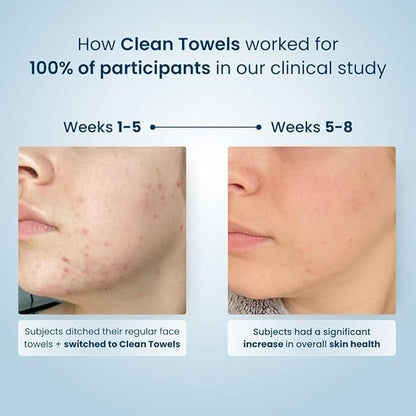 Clean Skin Club Clean Towels XL®, 100% USDA Biobased Face Towel, Disposable Face Towelette, Eczema Association Accepted, Makeup Remover Dry Wipes, Ultra Soft, 50 ct per pack, 4 Packs, 200 Ct Total