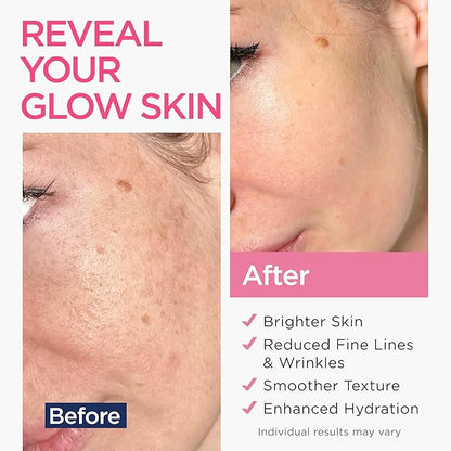 Retinol Serum for Face with Hyaluronic Acid, Vitamin E & Aloe Vera Anti-Aging Serum - All Skin Types - Supports Even Tone - Day and Night - Made in USA - 1 Oz