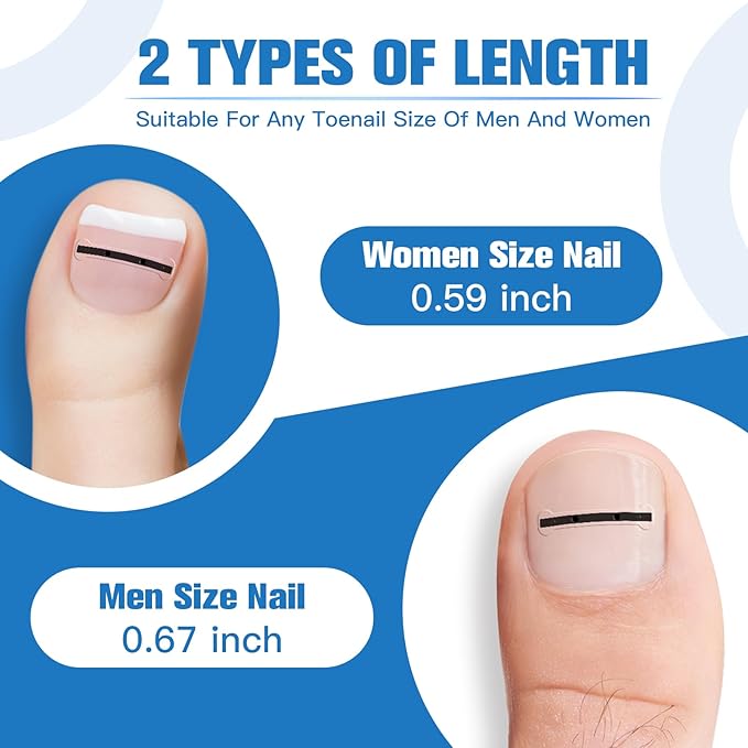 Titanium Alloy Ingrown Toenail Treatment, Ingrown Toenail Removal Kit for Curved Nail Repair, Ingrown Nail Tool for Home Use
