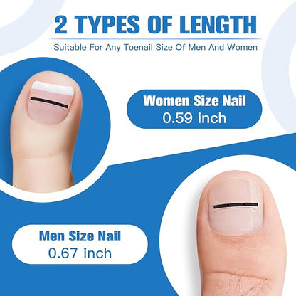 Titanium Alloy Ingrown Toenail Treatment, Ingrown Toenail Removal Kit for Curved Nail Repair, Ingrown Nail Tool for Home Use