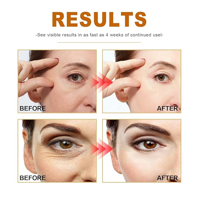 Collagen Boost Anti-Aging Serum, Collagen Peptide Anti-Wrinkle Serum, Collagen Face Serum For Skin Tightening Helps Lift, Plump, & Firm Sagging Skin, Serums For Skin Care, Anti Wrinkle Boost