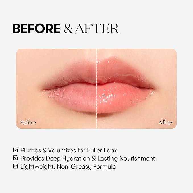 VTCOSMETICS Reedle Shot Lip Plumper, 0.15 oz (4.3 g), Moisturizing, Transparent, Lip Gloss, Fragrance-free, Korean Cosmetics (Expert)