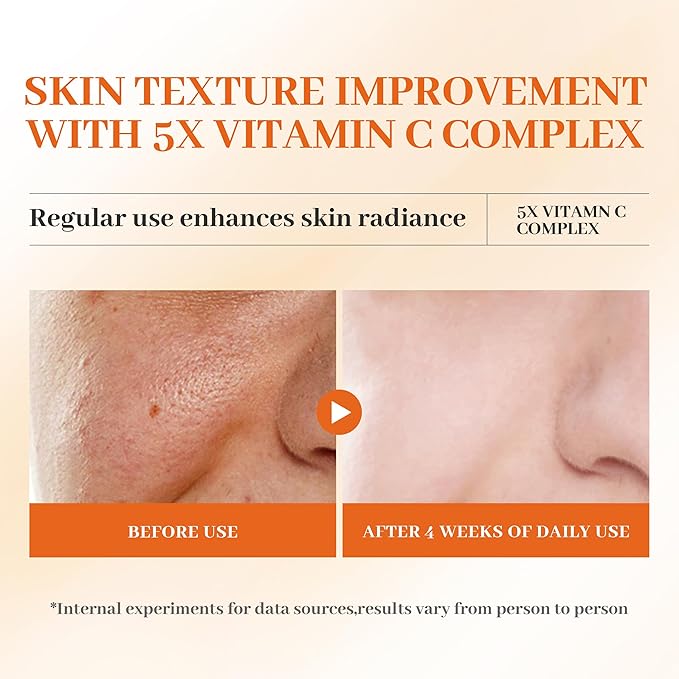 Premium 5X Vitamin C Korea Serum for Face 30ML,Hydrating Faical Essence,Hyaluronic Acid, Centella For Dull Facial Skin,Uneven Tone,Fine Lines,Pores (1 Serum)