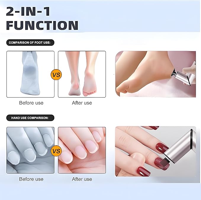 Foldable Electric Foot Callus Remover, Foot Files, 9-Speed Foot Sander Pedicure Tools for Feet Dead Skin with Sandpaper Disk and Nail Drill Bits（Rose Gold）