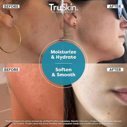 TruSkin Hyaluronic Acid Serum for Face + 7 Ultra Hydrating Ingredients – Best Face Serum for Moisturizing, Visibly Plumping Skin & Smoothing the Look of Fine Lines, 1 fl oz