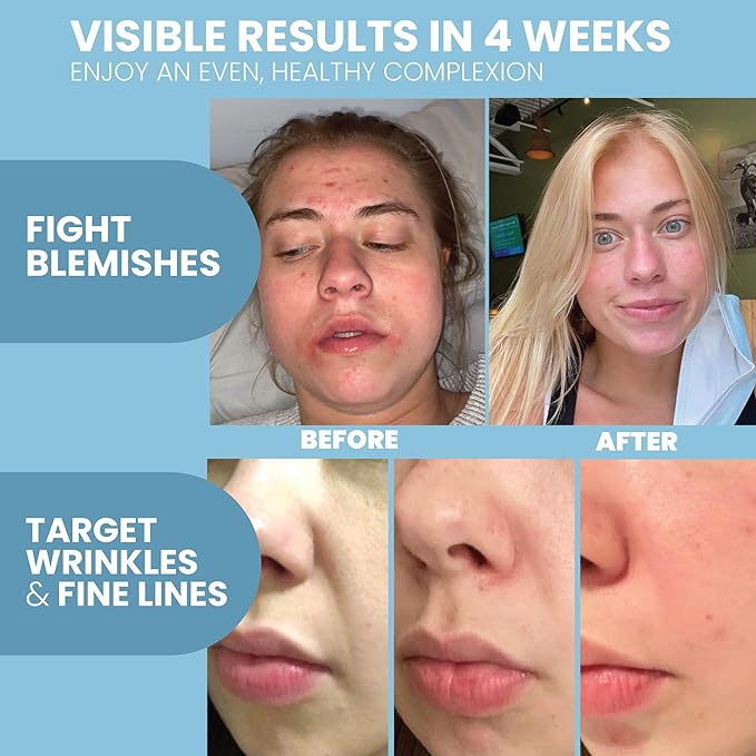 Retinol Serum by Eva Naturals - 2.5% Retinol Serum for Face with Hyaluronic Acid, Vitamin E & Organic Aloe - Retinol Face Serum that Reduce Wrinkles, Fine Lines & Dark Spots - Anti Aging Serum, 2 Pack