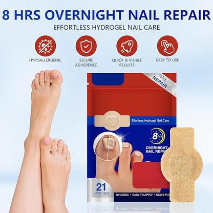 Toenail Repair Extra Strength,21 Patch,Nighttime Nail Patches,8-Hour Repair Appearance,for Damaged Nails Foot Nails Repair and Care,Strengthens Brittle Nail (2 PCS)