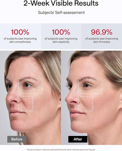 JMOON NouvelleSkin Facial Toning Device, M30U Red Light Therapy for Face, FDA-Cleared for Safer Treatment of Facial Wrinkles, 4 Modes, 5 Energy Levels for Full Face, JMOON Gel Included